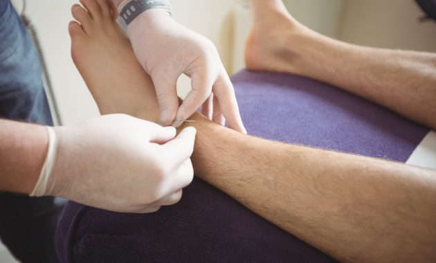 Pengobatan Alternatif untuk Nyeri Sendi