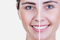 IMG-20231116-WA0036 Keunggulan Serum Anti Acne