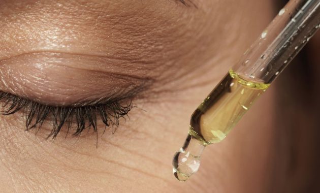 cara menghilangkan jerawat batu