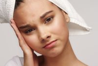 Penyebab Jerawat di Pipi?