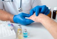 Apa Itu Lupus? Penyakit Autoimun yang Bisa Berdampak pada Sendi dan Tulang