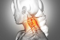 Feat 7 Obat nyeri sendi di apotik